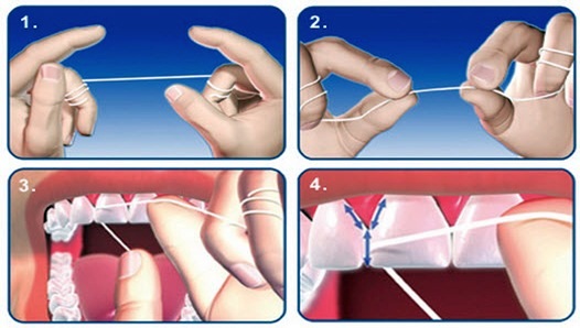 чистка зубной нитью